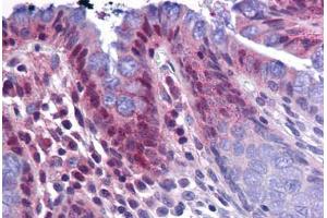 Human Colon: Formalin-Fixed, Paraffin-Embedded (FFPE)