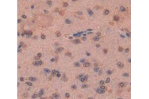 Used in DAB staining on fromalin fixed paraffin- embedded Kidney tissue (FZD1 anticorps  (AA 112-317))