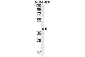 CCNYL3 Antibody (N-term) western blot analysis in NCI-H460 cell line lysates (35µg/lane). (CCNYL3 anticorps  (N-Term))