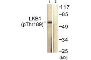 Western blot analysis of extracts from NIH-3T3 cells treated with PMA 125ng/ml 30', using LKB1 (Phospho-Thr189) Antibody. (LKB1 anticorps  (pThr189))