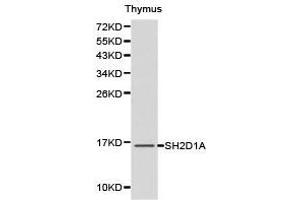 Western Blotting (WB) image for anti-SH2 Domain Containing 1A (SH2D1A) antibody (ABIN1874768) (SH2D1A anticorps)