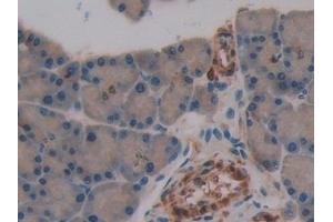 Detection of SNCG in Rat Pancreas Tissue using Polyclonal Antibody to Gamma-synuclein (SNCG)