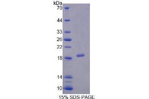 SDS-PAGE analysis of Human PCCa Protein. (PCCA Protéine)
