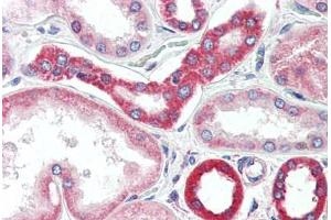 Human Kidney (formalin-fixed, paraffin-embedded) stained with BAK1 antibody ABIN461962 at 20 ug/ml followed by biotinylated goat anti-rabbit IgG secondary antibody ABIN481713, alkaline phosphatase-streptavidin and chromogen. (BAK1 anticorps)
