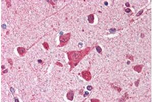 Human Brain, Cortex (formalin-fixed, paraffin-embedded) stained with TP53 antibody ABIN214388 at 2. (p53 anticorps)