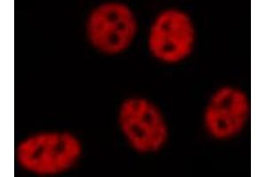 ABIN6272491 staining HUVEC by IF/ICC.