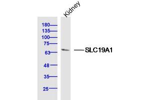 Mouse Kidney lysates probed with SLC19A1 Polyclonal Antibody, Unconjugated  at 1:300 dilution and 4˚C overnight incubation. (SLC19A1 anticorps  (AA 101-200))