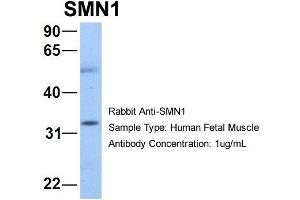 Host: Rabbit Target Name: NOP56 Sample Type: Human Fetal Muscle Antibody Dilution: 1.