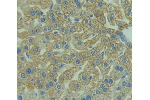 Used in DAB staining on fromalin fixed paraffin- embedded liver tissue (Reticulon 1 anticorps  (AA 593-780))