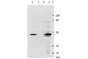 Western Blotting (WB) image for anti-Human Papilloma Virus Type 11 (HPV-11) (AA 83-201) antibody (ABIN781774) (Humain Papilloma Virus Type 11 (HPV-11) (AA 83-201) anticorps)