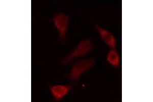 ABIN6274304 staining HepG2 cells by IF/ICC. (RED1 anticorps  (Internal Region))
