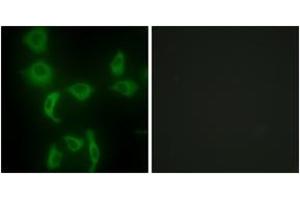 Immunofluorescence analysis of HepG2 cells, using IARS2 Antibody. (IARS2 anticorps  (AA 71-120))