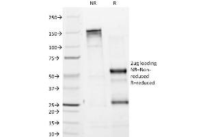 SDS-PAGE Analysis Purified Tyrosinase Monoclonal Antibody (T311). (TYR anticorps)