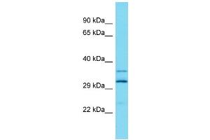 Host: Rabbit Target Name: ARL13A Sample Type: Fetal Liver lysates Antibody Dilution: 1. (ARL13A anticorps  (Middle Region))