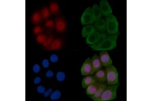 ABIN6266277 and ABIN6277434 staining Hela cells(45 min of heat-shock) by IF/ICC. (TCF7 anticorps  (N-Term))