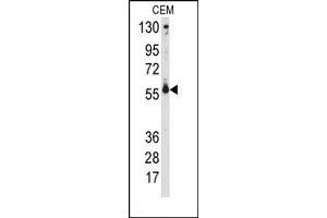 Image no. 1 for anti-Cytochrome P450, Family 2, Subfamily C, Polypeptide 9 (CYP2C9) (Middle Region) antibody (ABIN360247) (CYP2C9 anticorps  (Middle Region))