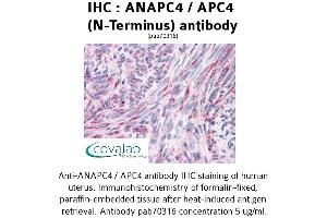Image no. 1 for anti-Anaphase Promoting Complex Subunit 4 (ANAPC4) (N-Term) antibody (ABIN1731762) (ANAPC4 anticorps  (N-Term))