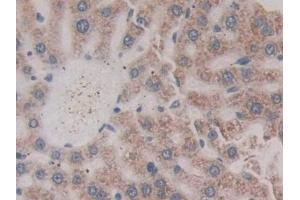 Detection of GP9 in Rat Liver Tissue using Polyclonal Antibody to Glycoprotein IX, Platelet (GP9)
