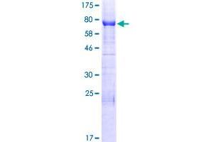 Image no. 1 for Inverted Formin, FH2 and WH2 Domain Containing (INF2) (AA 1-337) protein (GST tag) (ABIN1307903)