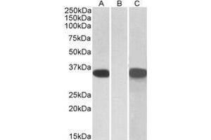 HEK293 lysate (10µg protein in RIPA buffer) overexpressing Human CRISP2 with C-terminal MYC tag probed with AP21265PU-N CRISP2 Antibody (1 µg/ml) in Lane A and probed with anti-MYC Tag (1/1000) in lane C. (CRISP2 anticorps  (AA 81-93))