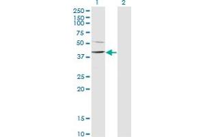 Western Blot analysis of SMARCB1 expression in transfected 293T cell line by SMARCB1 monoclonal antibody (M11), clone 3F11.