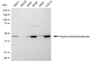 anti-Glycine Amidinotransferase (L-Arginine:glycine Amidinotransferase) (GATM) antibody