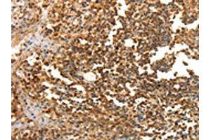 The image on the left is immunohistochemistry of paraffin-embedded Human tonsil tissue using ABIN7130100(LRP12 Antibody) at dilution 1/25, on the right is treated with fusion protein. (LRP12 anticorps)