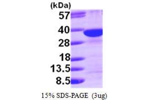 Syndecan Binding Protein (Syntenin) (SDCBP) (AA 1-298) protein (His tag)