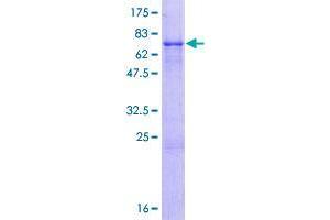 Image no. 1 for ZFP2 Zinc Finger Protein (ZFP2) (AA 1-461) protein (GST tag) (ABIN1325739)