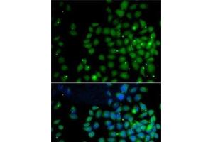 Immunofluorescence analysis of A-549 cells using UBD Polyclonal Antibody (UBD anticorps)