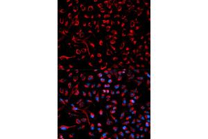 Immunofluorescence analysis of HeLa cells using DOK4 antibody (ABIN5970056). (DOK4 anticorps)