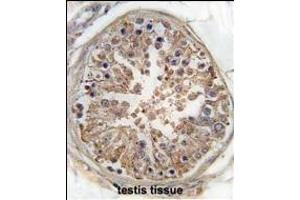 anti-Protein Kinase, AMP-Activated, alpha 2 Catalytic Subunit (PRKAA2) (AA 265-295) antibody