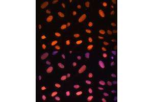 Immunofluorescence analysis of U-2 OS cells using ZNF581 Polyclonal Antibody (ABIN6128960, ABIN6150520, ABIN6150521 and ABIN6217055) at dilution of 1:100 (40x lens).