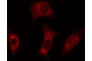 ABIN6277815 staining Hela cells by IF/ICC. (Caspase 4 anticorps)