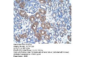 Rabbit Anti-ASS Antibody  Paraffin Embedded Tissue: Human Kidney Cellular Data: Epithelial cells of renal tubule Antibody Concentration: 4.