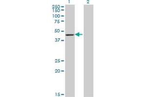 Western Blot analysis of ARFIP1 expression in transfected 293T cell line by ARFIP1 monoclonal antibody (M05), clone 1F10. (ARFIP1 anticorps  (AA 1-101))