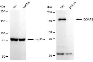 Western blotting analysis using IQGAP2 antibody (ABIN7799123).
