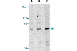 Western blot analysis of DDX58 in C2C12 cell lysate with DDX58 polyclonal antibody  at (A) 0. (DDX58 anticorps)