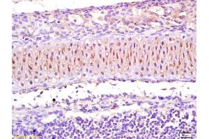 Formalin-fixed and paraffin embedded mouse embryo labeled with Rabbit Anti CACNA1S Polyclonal Antibody, Unconjugated (ABIN1387901) at 1:200 followed by conjugation to the secondary antibody and DAB staining