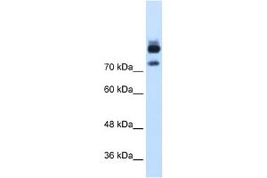 WB Suggested Anti-MTMR1 Antibody Titration:  1. (MTMR1 anticorps  (C-Term))