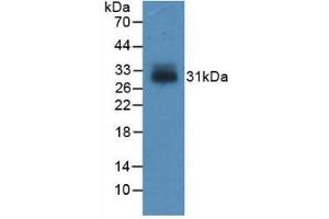Western blot analysis of recombinant Human IGFBP4. (IGFBP4 anticorps  (AA 22-258))