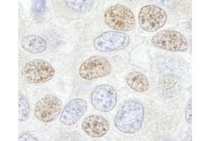 Immunohistochemistry (IHC) image for anti-DEAD (Asp-Glu-Ala-Asp) Box Polypeptide 46 (DDX46) (C-Term) antibody (ABIN7448521) (DDX46 anticorps  (C-Term))