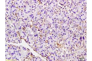 Formalin-fixed and paraffin embedded rat pancreas tissue labeled with Anti-CD105 Polyclonal Antibody, unconjugated(ABIN707561) at 1: 200 followed by incubation with conjugated secondary antibody and DAB staining (Endoglin anticorps  (AA 58-110))