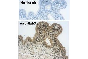 Immunohistochemistry (IHC) image for anti-RAB7A, Member RAS Oncogene Family (RAB7A) (C-Term) antibody (ABIN6254195)