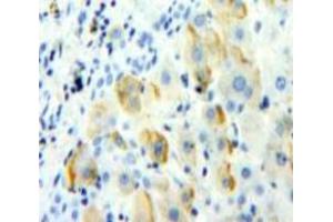 Used in DAB staining on fromalin fixed paraffin-embedded Liver tissue (TREM1 anticorps  (AA 21-205))