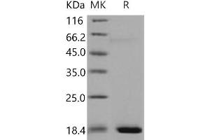Western Blotting (WB) image for Regenerating Islet-Derived 3 alpha (REG3A) protein (His tag) (ABIN7320383)