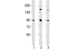 Western blot testing of SUZ12 antibody at 1:2000 dilution.