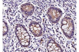 ABIN6268764 at 1/100 staining human colon tissue sections by IHC-P. (Claudin 5 anticorps)