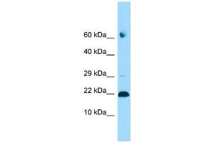WB Suggested Anti-ADAT2 Antibody Titration: 1.