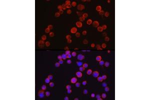 Immunofluorescence analysis of Jurkat cells using Tec Rabbit pAb (ABIN6128353, ABIN6148988, ABIN6148989 and ABIN6213654) at dilution of 1:50 (40x lens). (NR4A3 anticorps  (AA 1-280))